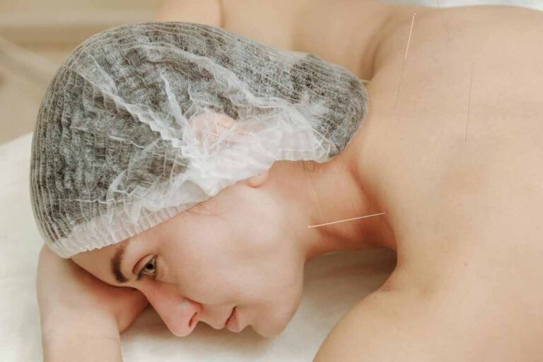 acupuncture-near-me