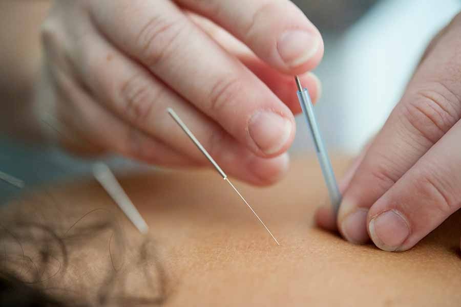acupuncturist-vancouver